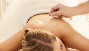 acupuncture & dry needling treatment in Stevenage, Hertfordshire